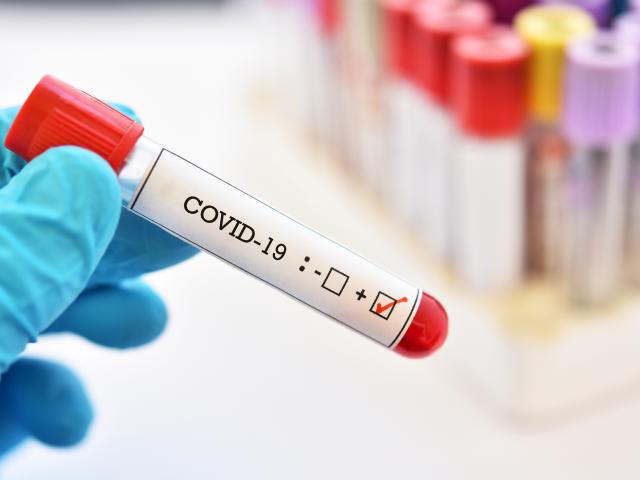Un nou caz COVID-19 în Olt. Este vorba despre o femeie care are legătură cu focarul din cadrul fabricii Caracal Un nou caz COVID-19 în Olt. Este vorba despre o femeie care are legătură cu focarul din cadrul fabricii Caracal