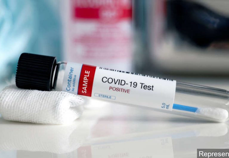 Informaţii oficiale despre ultimele 3 persoane din Olt, confirmate cu COVID-19: Contacţi de familie ai persoanelor anterior diagnosticate pozitiv Informaţii oficiale despre ultimele 3 persoane din Olt, confirmate cu COVID-19: Contacţi de familie ai persoanelor anterior diagnosticate pozitiv