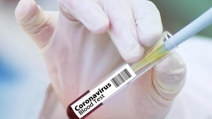 156 de victime ale noului coronavirus 156 de victime ale noului coronavirus