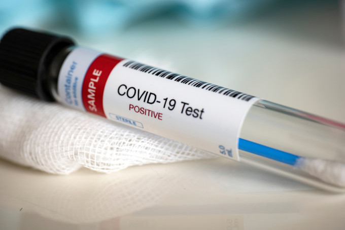 Două decese COVID-19, în Olt. Cu 37 de infectări, a fost trecut pragul de 1.900 de cazuri Două decese COVID-19, în Olt. Cu 37 de infectări, a fost trecut pragul de 1.900 de cazuri