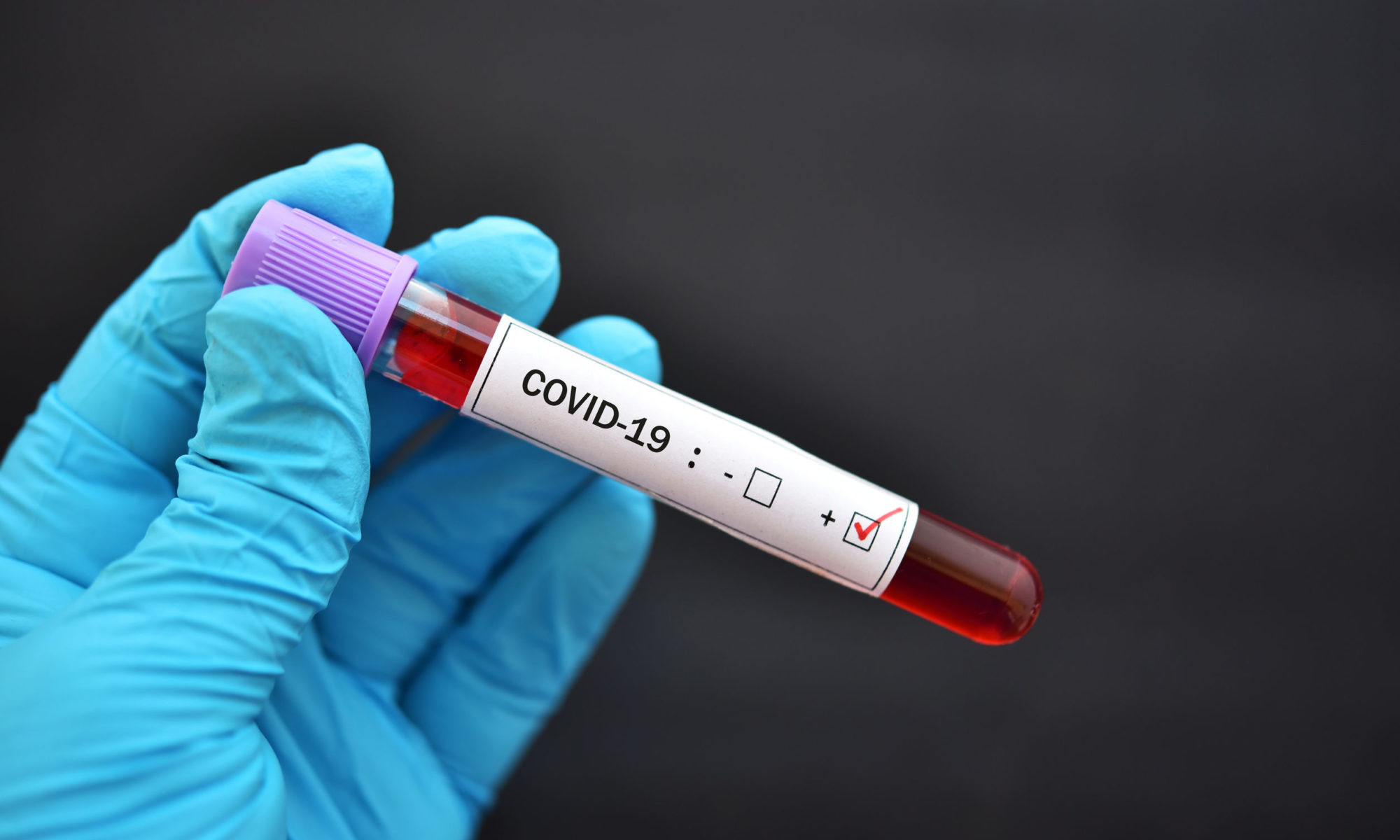 Zi neagră. 56 de infectări COVID-19 şi din nou pe lista deceselor. Record absolut şi la nivel naţional Zi neagră. 56 de infectări COVID-19 şi din nou pe lista deceselor. Record absolut şi la nivel naţional