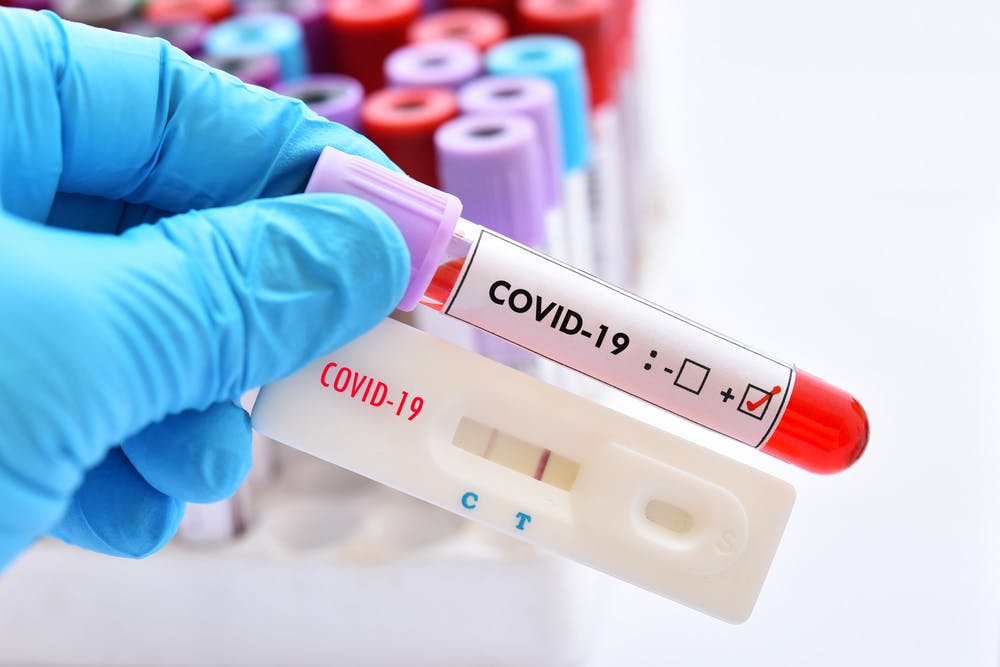 Oltul raportează două cazuri Covid-19, în ultimele 24 de ore. Incidenţa este 0,02 Oltul raportează două cazuri Covid-19, în ultimele 24 de ore. Incidenţa este 0,02